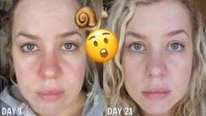 snail mucin before and after