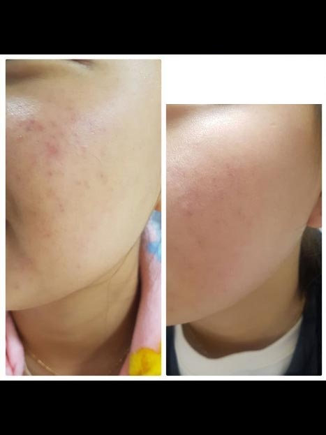 Incellderm customer review and photo 007