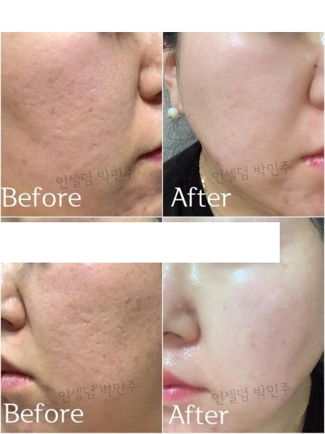 Incellderm customer review and photo 009
