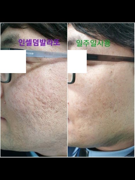 Incellderm customer review and photo 012