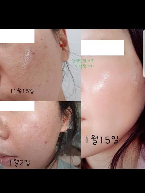 Incellderm customer review and photo 014