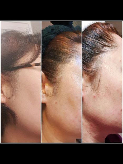 Incellderm customer review and photo 003