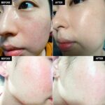 Dear Klairs Midnight Blue Calming Cream (2) Dear Klairs Midnight Blue Calming Cream before and after