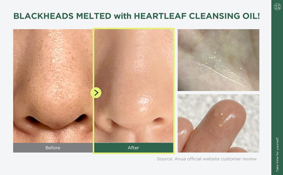 Heartleaf Pore Control Cleansing Oil